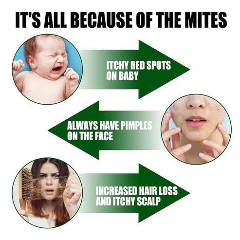 Green Prickly Ash Herbal Mite Remover